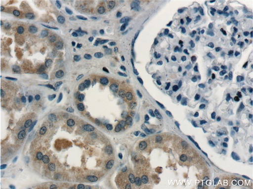 [24368-1-AP-150UL] RBM46 Polyclonal antibody