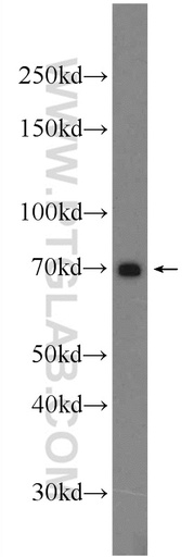 [24369-1-AP-150UL] TRIM67 Polyclonal antibody