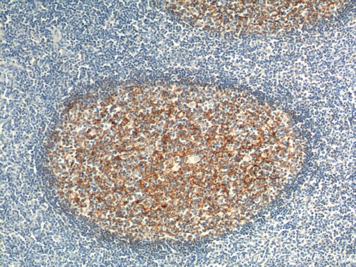 [24374-1-AP-20UL] CD21 Polyclonal antibody