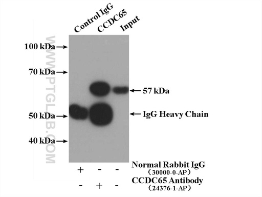 [24376-1-AP-20UL] CCDC65 Polyclonal antibody