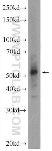 [24377-1-AP-150UL] SETD6 Polyclonal antibody
