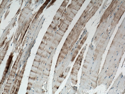 [24378-1-AP-150UL] ACTN3 Polyclonal antibody