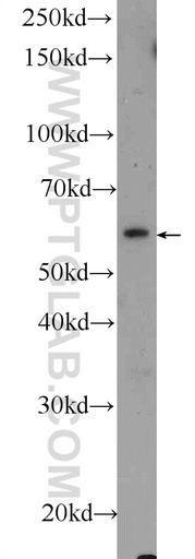 [24383-1-AP-150UL] Shootin 1 Polyclonal antibody