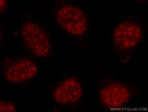 [24384-1-AP-150UL] C17orf85 Polyclonal antibody
