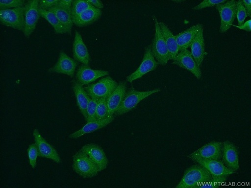 [24390-1-AP-20UL] PERK/EIF2AK3 Polyclonal antibody
