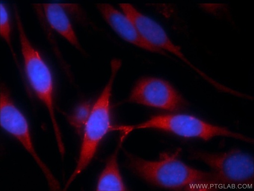 [24395-1-AP-20UL] MLK4 Polyclonal antibody