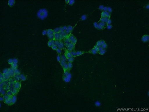 [24399-1-AP-20UL] GPATCH4 Polyclonal antibody