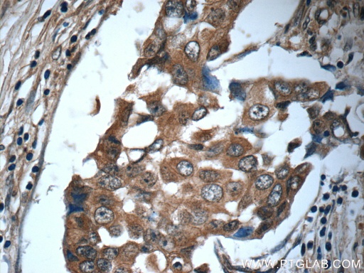 [24402-1-AP-20UL] IL-19 Polyclonal antibody