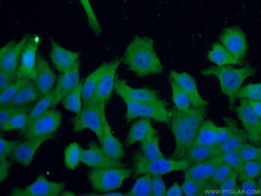 [24403-1-AP-150UL] TRIM16 Polyclonal antibody