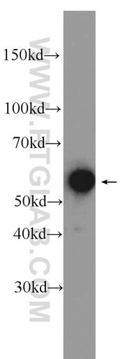 [24405-1-AP-150UL] GTF2E1 Polyclonal antibody