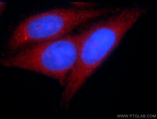 [24409-1-AP-150UL] KTELC1 Polyclonal antibody
