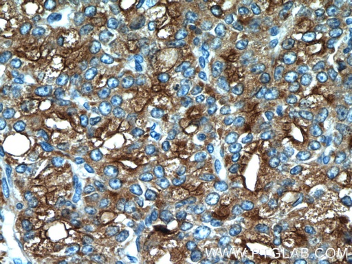 [24410-1-AP-20UL] ACPP Polyclonal antibody