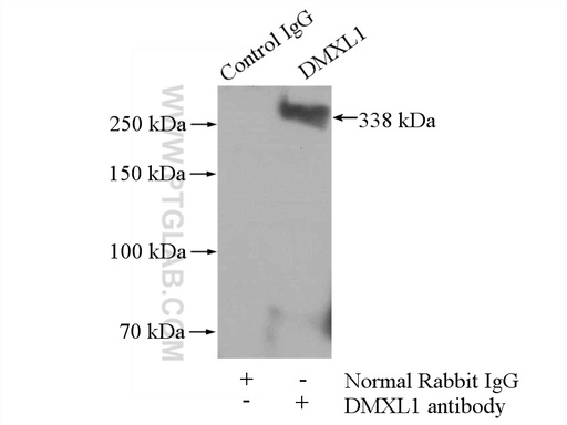 [24413-1-AP-20UL] DMXL1 Polyclonal antibody