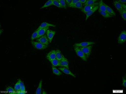 [24416-1-AP-150UL] CWC25 Polyclonal antibody
