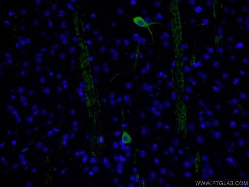 [24418-1-AP-20UL] CHAT Polyclonal antibody