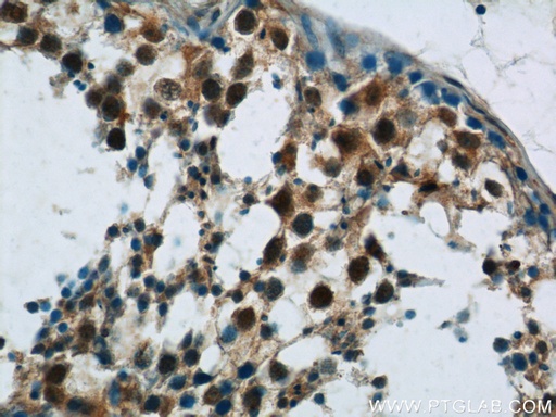 [24419-1-AP-150UL] FAM48A Polyclonal antibody