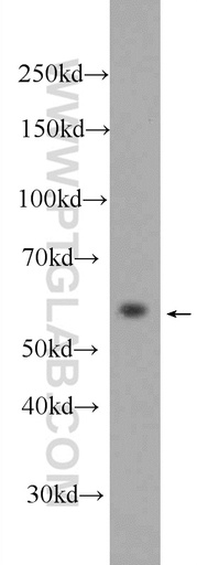 [24420-1-AP-150UL] MPND Polyclonal antibody