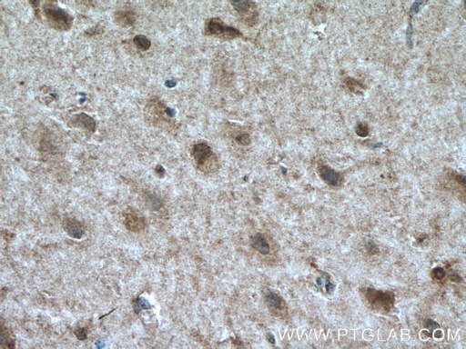 [24421-1-AP-20UL] TALPID3 Polyclonal antibody