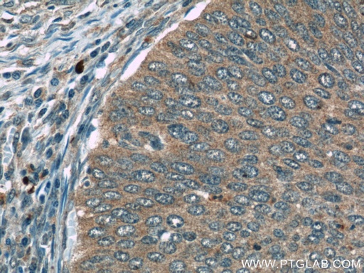 [24422-1-AP-20UL] FAM168B Polyclonal antibody
