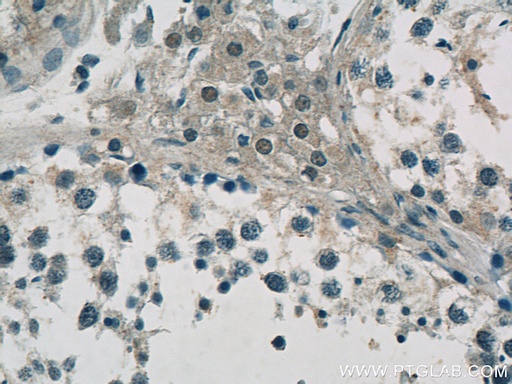 [24424-1-AP-150UL] C10orf27 Polyclonal antibody