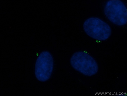 [24428-1-AP-20UL] CEP135 Polyclonal antibody