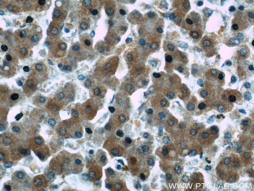 [24431-1-AP-150UL] WDR7 Polyclonal antibody