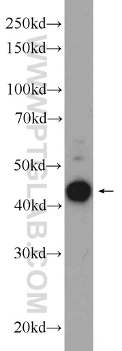 [24433-1-AP-150UL] LYAR Polyclonal antibody