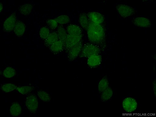[24436-1-AP-150UL] BRIP1(N-terminal) Polyclonal antibody