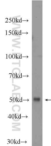 [24437-1-AP-20UL] IRF8 Polyclonal antibody