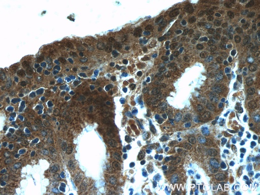 [24439-1-AP-150UL] NUP205 Polyclonal antibody