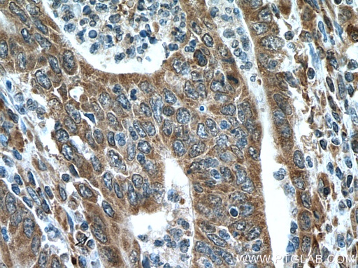 [24440-1-AP-150UL] IRX6 Polyclonal antibody