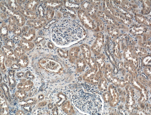 [24449-1-AP-20UL] CCBE1 Polyclonal antibody
