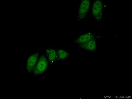[24450-1-AP-20UL] PPP1R10 Polyclonal antibody