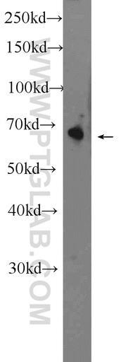 [24456-1-AP-150UL] OTOP1 Polyclonal antibody