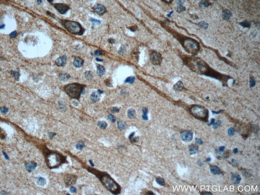 [24457-1-AP-20UL] CEP44 Polyclonal antibody