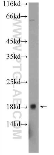 [24459-1-AP-150UL] C10orf67 Polyclonal antibody