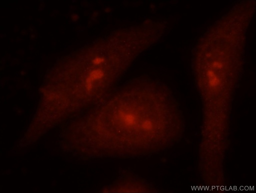 [24470-1-AP-20UL] EXOSC9 Polyclonal antibody