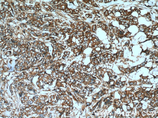 [24472-1-AP-150UL] GEF-H1 Polyclonal antibody