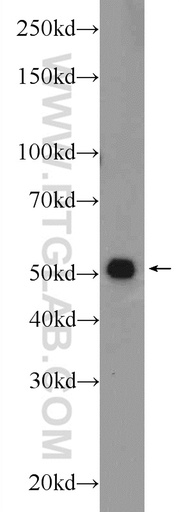 [24477-1-AP-20UL] TMEM194A Polyclonal antibody