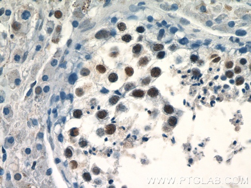 [24480-1-AP-150UL] PRPF39 Polyclonal antibody