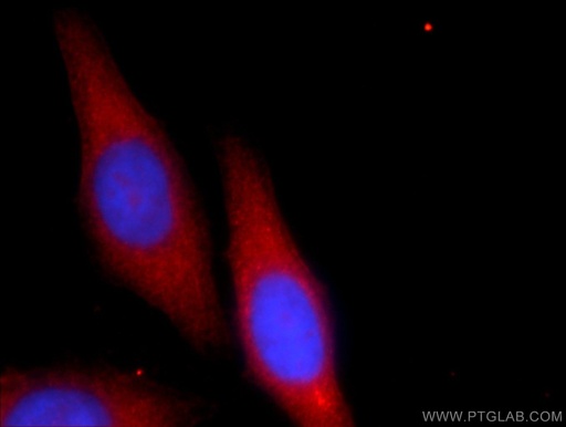 [24484-1-AP-150UL] AMZ1 Polyclonal antibody
