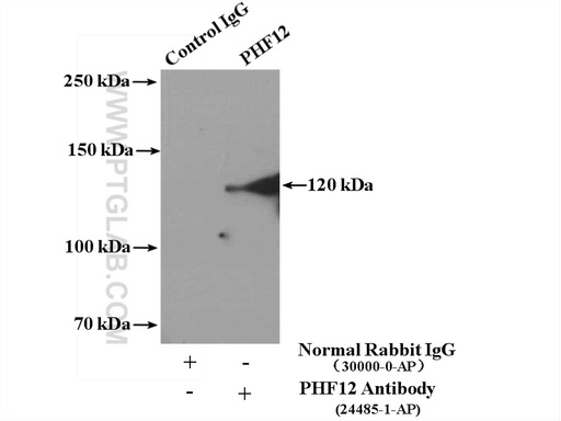 [24485-1-AP-150UL] PHF12 Polyclonal antibody