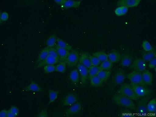 [24486-1-AP-150UL] OTUD6A Polyclonal antibody