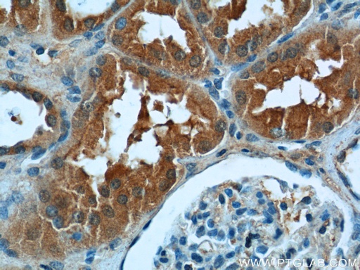 [24488-1-AP-150UL] DNAH17 Polyclonal antibody