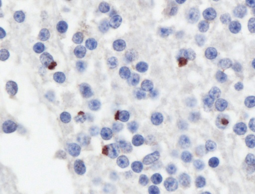 [24494-1-AP-20UL] GP repeat Polyclonal antibody
