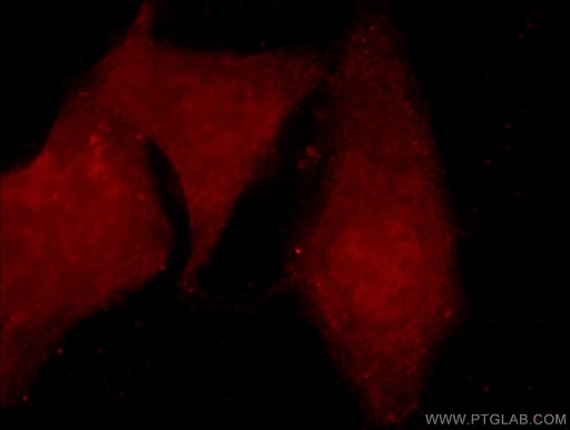 [24499-1-AP-20UL] ARID4B Polyclonal antibody