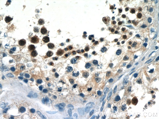[24500-1-AP-20UL] SALL4 Polyclonal antibody