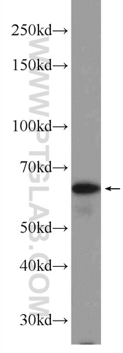 [24502-1-AP-150UL] PPP2R3B Polyclonal antibody