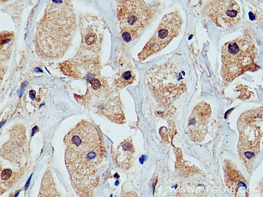 [24503-1-AP-20UL] PRKACA Polyclonal antibody