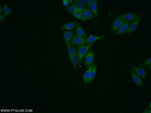 [24505-1-AP-20UL] VPS13B Polyclonal antibody